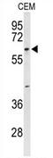 Trichoplein Keratin Filament Binding antibody, AP54204PU-N, Origene, Western Blot image 