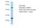 Katanin Catalytic Subunit A1 Like 1 antibody, A11734, Boster Biological Technology, Western Blot image 