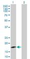 5-Phosphohydroxy-L-Lysine Phospho-Lyase antibody, H00085007-B01P, Novus Biologicals, Western Blot image 