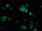 Cell Adhesion Associated, Oncogene Regulated antibody, LS-C671547, Lifespan Biosciences, Immunofluorescence image 