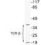 T-cell receptor beta chain V region 86T1 antibody, LS-C200021, Lifespan Biosciences, Western Blot image 