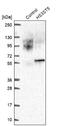Heparan Sulfate-Glucosamine 3-Sulfotransferase 5 antibody, NBP2-55930, Novus Biologicals, Western Blot image 
