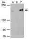 DNA Topoisomerase II Beta antibody, GTX102640, GeneTex, Immunoprecipitation image 