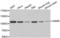 Oncostatin M Receptor antibody, LS-C334872, Lifespan Biosciences, Western Blot image 