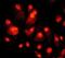 HRas Proto-Oncogene, GTPase antibody, ab32417, Abcam, Immunofluorescence image 