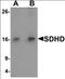 Succinate Dehydrogenase Complex Subunit D antibody, orb137322, Biorbyt, Western Blot image 