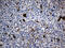 PTPN22 antibody, M00581, Boster Biological Technology, Immunohistochemistry paraffin image 