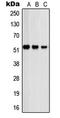 Proteasome 26S Subunit, Non-ATPase 12 antibody, LS-C352732, Lifespan Biosciences, Western Blot image 