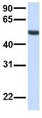 Macoilin 1 antibody, GTX46302, GeneTex, Western Blot image 