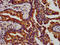 Integrin Subunit Beta 6 antibody, LS-C670495, Lifespan Biosciences, Immunohistochemistry paraffin image 