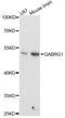 Gamma-Aminobutyric Acid Type A Receptor Gamma1 Subunit antibody, A14240, ABclonal Technology, Western Blot image 