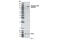 CYLD Lysine 63 Deubiquitinase antibody, 4500T, Cell Signaling Technology, Western Blot image 