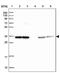 Tetratricopeptide Repeat Domain 19 antibody, PA5-62597, Invitrogen Antibodies, Western Blot image 