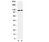 Solute Carrier Family 12 Member 3 antibody, R31291, NSJ Bioreagents, Western Blot image 