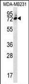 SIX Homeobox 5 antibody, PA5-35125, Invitrogen Antibodies, Western Blot image 