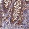 Chaperonin Containing TCP1 Subunit 6A antibody, HPA045576, Atlas Antibodies, Immunohistochemistry frozen image 