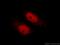 EF-Hand Calcium Binding Domain 5 antibody, 24296-1-AP, Proteintech Group, Immunofluorescence image 