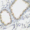 Fms Related Tyrosine Kinase 4 antibody, 19-753, ProSci, Immunohistochemistry paraffin image 