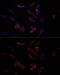 MCL1 Apoptosis Regulator, BCL2 Family Member antibody, GTX55698, GeneTex, Immunofluorescence image 