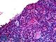 T Cell Lymphoma Invasion And Metastasis 1 antibody, LS-B5100, Lifespan Biosciences, Immunohistochemistry paraffin image 