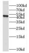 Pseudouridine Synthase 1 antibody, FNab06958, FineTest, Western Blot image 