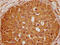 GLI Family Zinc Finger 2 antibody, CSB-PA009500OA01HU, Cusabio, Immunohistochemistry paraffin image 