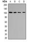 Coatomer Protein Complex Subunit Beta 1 antibody, orb341223, Biorbyt, Western Blot image 