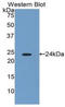 Interferon Beta 1 antibody, LS-C314442, Lifespan Biosciences, Western Blot image 