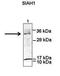 Siah E3 Ubiquitin Protein Ligase 1 antibody, orb329760, Biorbyt, Western Blot image 