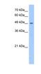 Patatin Like Phospholipase Domain Containing 5 antibody, NBP1-70679, Novus Biologicals, Western Blot image 