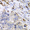 S100 Calcium Binding Protein A8 antibody, LS-C331639, Lifespan Biosciences, Immunohistochemistry frozen image 