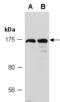 Tet Methylcytosine Dioxygenase 3 antibody, M1092-3, Abiocode, Western Blot image 