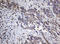 NADH:Ubiquinone Oxidoreductase Subunit B10 antibody, LS-C174154, Lifespan Biosciences, Immunohistochemistry frozen image 