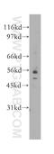 Eukaryotic Translation Initiation Factor 2B Subunit Gamma antibody, 11296-2-AP, Proteintech Group, Western Blot image 