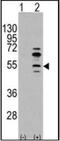 Myocyte Enhancer Factor 2C antibody, orb89015, Biorbyt, Western Blot image 