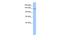 Cache Domain Containing 1 antibody, A16146, Boster Biological Technology, Western Blot image 