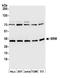 Spermidine Synthase antibody, A305-505A, Bethyl Labs, Western Blot image 