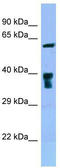 Solute Carrier Family 22 Member 5 antibody, TA343308, Origene, Western Blot image 