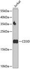 CD3d Molecule antibody, A04405, Boster Biological Technology, Western Blot image 