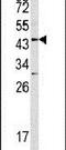 Asporin antibody, PA5-13553, Invitrogen Antibodies, Western Blot image 