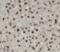 Ubiquitin C antibody, FNab09152, FineTest, Immunohistochemistry paraffin image 