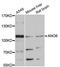 Anoctamin 6 antibody, STJ113951, St John