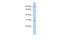 Cation Channel Sperm Associated Auxiliary Subunit Delta antibody, A12612, Boster Biological Technology, Western Blot image 