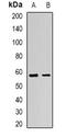 Adiponectin Receptor 1 antibody, LS-C482286, Lifespan Biosciences, Western Blot image 