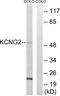 Potassium Voltage-Gated Channel Modifier Subfamily G Member 2 antibody, PA5-39352, Invitrogen Antibodies, Western Blot image 