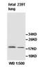 Anterior Gradient 3, Protein Disulphide Isomerase Family Member antibody, orb77889, Biorbyt, Western Blot image 