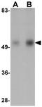 Isocitrate Dehydrogenase (NADP(+)) 2, Mitochondrial antibody, GTX17090, GeneTex, Western Blot image 