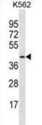 MGAT4 Family Member D antibody, abx030313, Abbexa, Western Blot image 