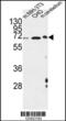 Activating Transcription Factor 6 Beta antibody, 61-792, ProSci, Western Blot image 