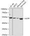 Acid Phosphatase, Prostate antibody, GTX64623, GeneTex, Western Blot image 